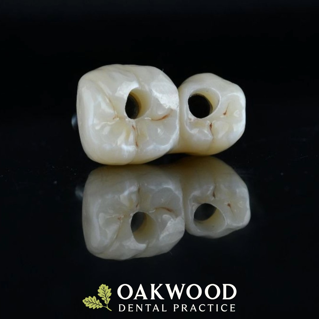 A dental implant is a permanent solution for replacing a missing tooth. A small titanium post is placed into the jawbone to act as a replacement root, before a custom-made crown is fitted on top for a natural-looking, fully functional smile.

With advanced digital planning, implant treatment is precise, predictable, and tailored to you.

Interested in restoring your smile? Book a consultation with our team today.

#DentalImplants #SmileRestoration #MissingTeeth #ImplantDentistry #DigitalDentistry #HealthySmile #oakwooddentalpractice @vivodentallab