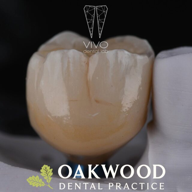 Missing a tooth? Dental implants are a long-lasting, natural-looking way to restore your smile.

At Oakwood Dental Practice, your implant journey is completed in-house using advanced digital planning and personalised care every step of the way.

Book your consult#healthysmile 

@vivodentallab 

#DentalImplants #OakwoodDental #SmileRestoration #DigitalDentistry #HealthySmile